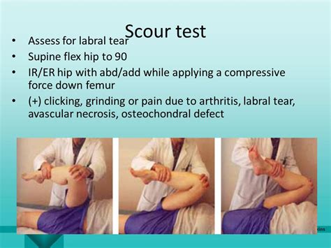 accuracy of hip labrum tear tests|hip labral tear test.